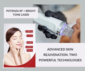 potenza microneedling
